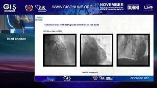 18 Left Main Intervention Complications Case Scenarios   Imad Sheiban