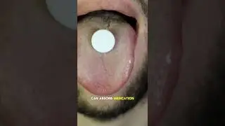Unlocking the Science of Sublingual Medication