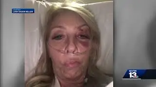 Etowah County Commission candidate recovering from severe injuries
