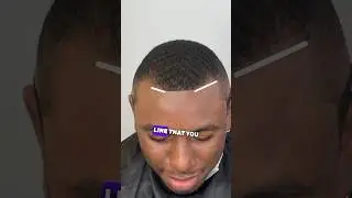 Fix Hairline No Enhancement Black Spray‼️ 💈 #hairline #hairlinerestoration