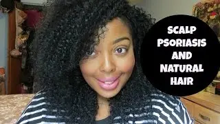 Scalp Psoriasis & Natural Hair l Tips & Tricks