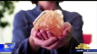 Miracle Monday: Treating congenital heart disease at all age