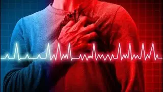 6 sinais de que você pode estar tendo uma arritmia |Dr. Dayan Siebra