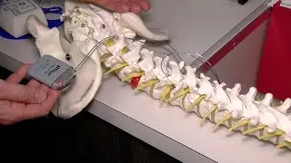 Local medical team offers Spinal Cord Stimulation to help back pain