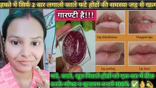 बरसों पुरानी जिद्दी Lip Tanning को हटाये इन steps से घर पर 😱/ Lip Care #beauty #lipcare #diy