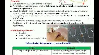 Nasogastric Tube NG