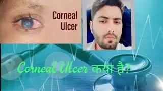 Corneal Ulcer कया है?