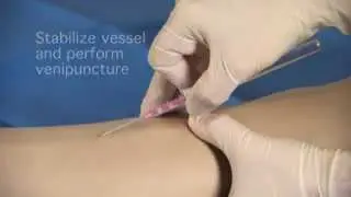 BD Insyte Autoguard BC Protective IV catheters