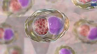 Chlamydia link to male infertility | Hudson Institute