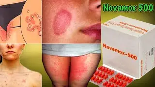 Novamox 500mg Capsule | Amoxicillin Trihydrate Capsule IP 500mg Capsule Full Detail In Hindi