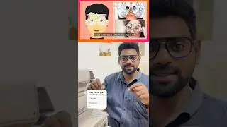 How Eyepower is Checked? #circleyewears #eyecheup #tamil #eyecaretips #eyedoctor #eyeweartipstamil