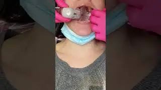 Дентальная изоляция: IsoDry #шорты