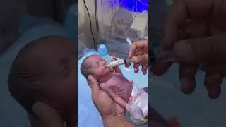 ave Little Fighter! Baby&rsquo;s Inspiring Recovery Journey After Tough Battle #amnioticfluid #kidspain