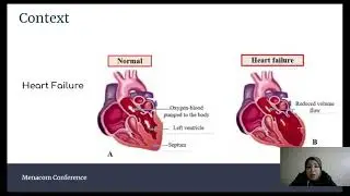 Detecting Heart Failure from Chest X-RAY Images Using Deep Learning Algorithms