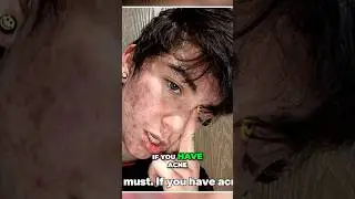 Clear Skin Secrets | Men's Guide to Acne Free Face