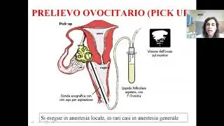 Il percorso di procreazione medicalmente assistita (PMA)