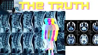 Being Honest : Stress of a MRI Tech