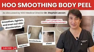 SMOOTHING BODY PEEL TO LIGHTEN AND EVEN OUT SKIN DISCOLORATION
