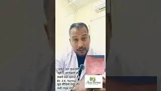 🧴 Moisturizer in Vitiligo &ndash; Small Step, Big Impact