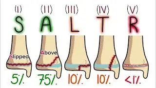 Salter Harris classification| orthopedic classifications 