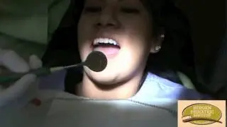 Dental mirror