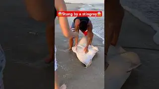 😱Stung by a stingray😱 #shorts #fish #fishing #florida #longisland #ny #shark #beach #sharkfishing