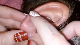 ASMR CLEANING EAR LOBE, INSPECTION EAR.