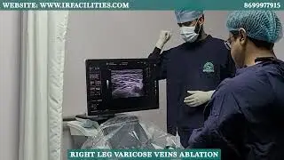 Varicose Veins Ablation in a Laughing Patient | Painless EVLA Procedure | Dr. Sandeep Sharma