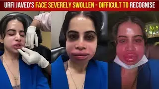 Urfi Javed Serious Condition And Crying In Pain After Lip Filler Treatment Went Wrong