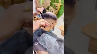 Anas Sheikh Hair Solution | Short Hair Video | #Shorts #viral #hairpatch #shortvideo  | 9650914665