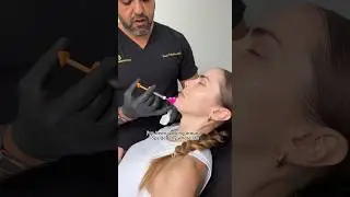 Thank you so much Modern Asthetica! 🥰🩷 #chinfiller #plasticsurgery #filler