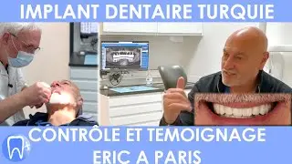 Implants en Turquie et Suivi à Paris - Témoignage Eric