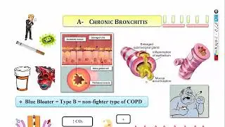 4-COPD, Pulmonary hypertension & Cor pulmonale شرح باطنة دكتور سويلم