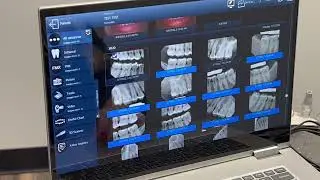 Pixel Dental Imaging Software Demo