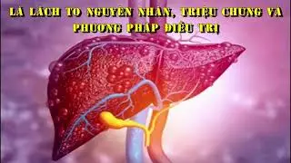 L&aacute; L&aacute;ch To L&agrave; G&igrave;? Nguy Hiểm Kh&ocirc;ng? Triệu Chứng & C&aacute;ch Điều Trị Hiệu Quả || Sức Khỏe - Ẩm Thực