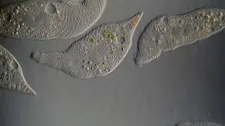 Lacrymaria (ciliate) | Under Microscope