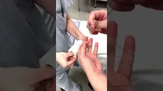 Как завязать самый ловкий хирургический узел