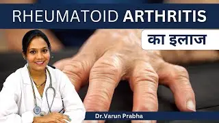 Rheumatoid Arthritis Treatment in Hindi | Diagnosis, Test, Medicines & Lifestyle Modifications