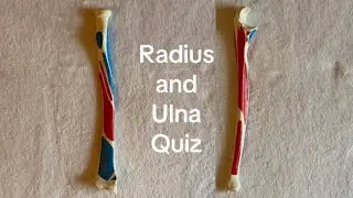Guided Quiz: Radius and Ulna Anatomy