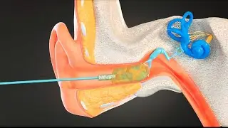 Working Of Human Ear,Structure, Function(Urdu/Hindi) Ear, piercing ear, ear infection, human primate