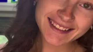 Aligner Co Teeth Whitening Kit