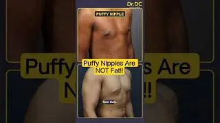 Puffy Nipples Are NOT Fat | Grade 1 Gynecomastia Explained! | Dr DC, Plastic Surgeon