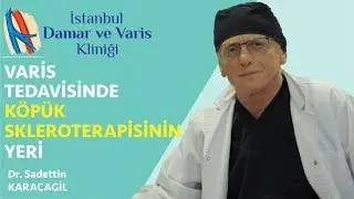 Varis Tedavisinde Köpük Skleroterapisinin Yeri