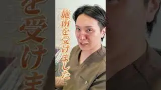 話題の&ldquo;皮脂フィラメント&rdquo;ってどんなもの？【皮膚科専門医が解説】 #shorts #毛穴 #いちご鼻 #美容