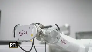 Eye On Health: ROSA robot helping patients with epilepsy