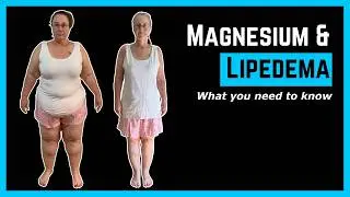 The Lipedema Pain Crisis - Which magnesium do you need?