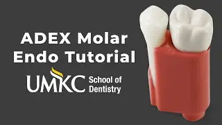 How to Access Tooth #14 for ADEX Endodontic Exam