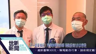 世新新聞 不一定要換肝！電燒射頻燒灼術 根除肝癌5年未復發