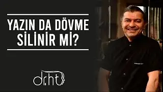 Yazın da Dövme Silinir mi ?