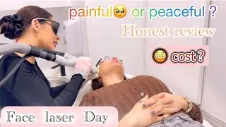 AUSTRALIA LASER HAIR TREATMENT COST😳 HONEST EXPERIENCE||ADELAIDE||#silklaser#minivlog 